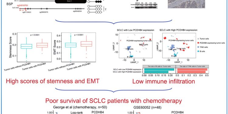 New prognostic biomarker identified in small cell lung cancer