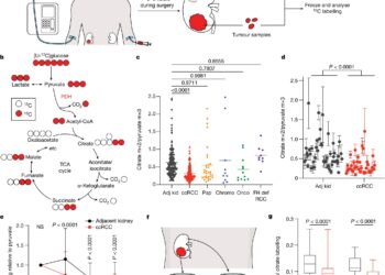 Scientists Discover Kidney Cancers Rely on Mitochondrial Metabolism to Metastasize