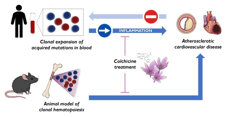 Scientists Discover New Cardiovascular Risk Factor and Identify Drug That Can Reduce Its Effects