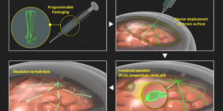 Self-deployable biodegradable electrode provides minimally invasive brain signal monitoring