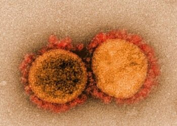 Spike gene mutations discovered that help SARS-CoV-2 infect the brain
