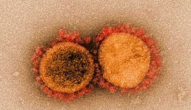 Spike gene mutations discovered that help SARS-CoV-2 infect the brain