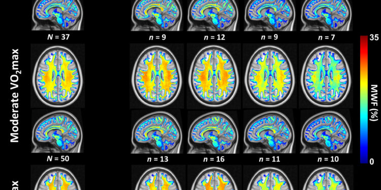 Study Links Cardiovascular Fitness to Brain Health