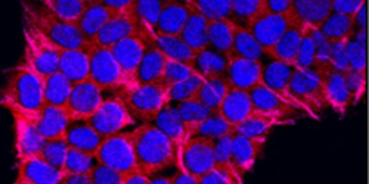 Study identifies metabolic switch critical to memory T cell generation and antitumor immunity