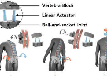 The bilateral back extensor exoskeleton