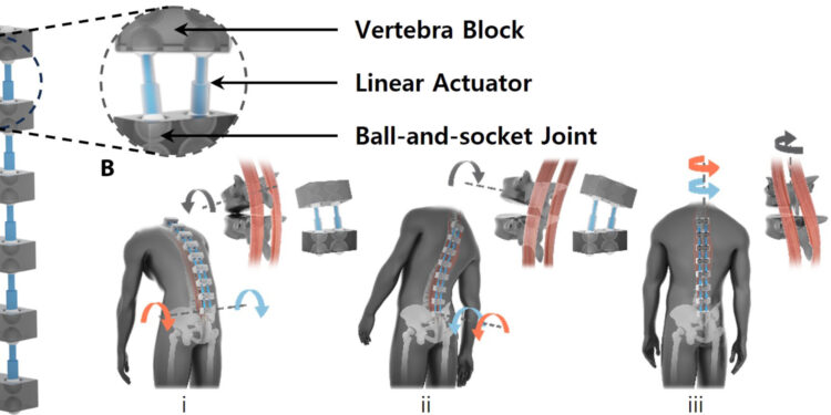 The bilateral back extensor exoskeleton