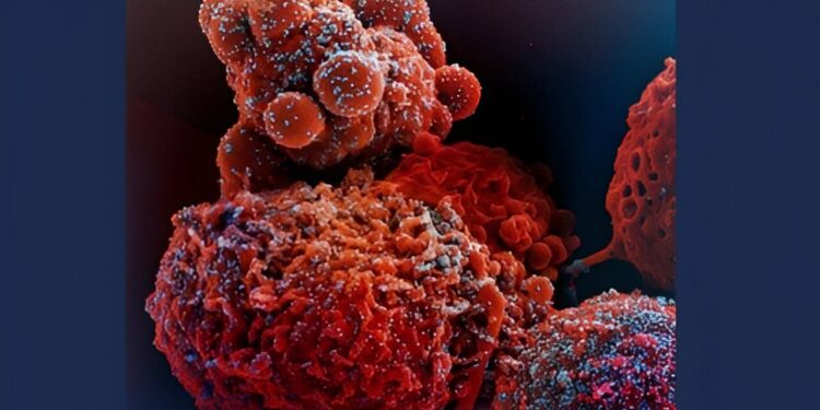 To subvert the immune response, SARS-CoV-2 stimulates the production of proteins without protective function