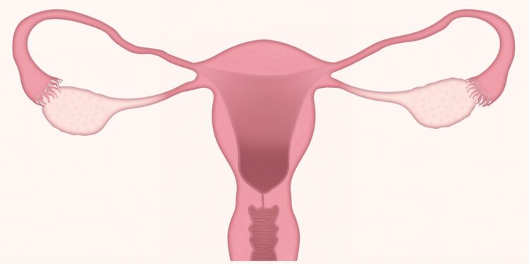 Uterine cancer tumors are more aggressive in black patients than in white patients