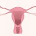 Uterine cancer tumors are more aggressive in black patients than in white patients