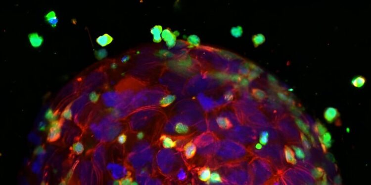 3D-printed mini-tumors mimic human tissue for cancer immunotherapy testing