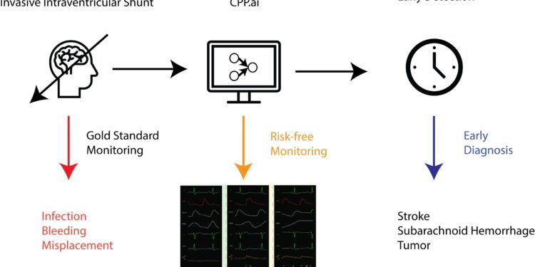 AI-powered tool could improve brain pressure monitoring in intensive care patients