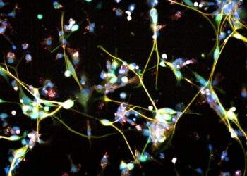 Antidepressant shows promise for treating brain tumors