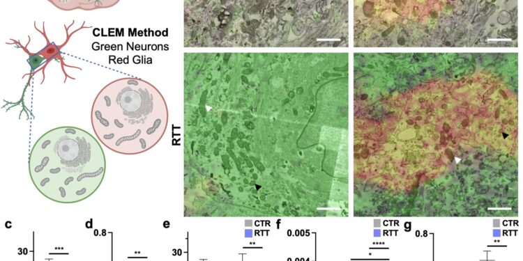 Brain cell types affected differently by Rett syndrome mutation, researchers find