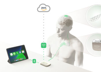 Brain implant lets man control Amazon’s Alexa with his mind