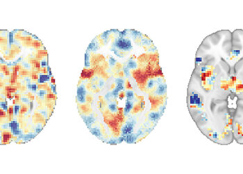 Brain scans reveal mindfulness meditation for pain is not a placebo