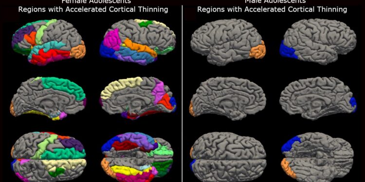 COVID-19 lockdowns are prematurely aging teen brains, study finds