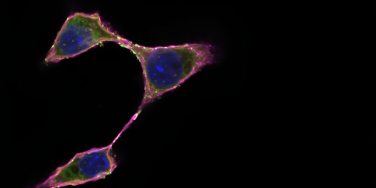 Cancer cells may use lipids to hide from the immune system