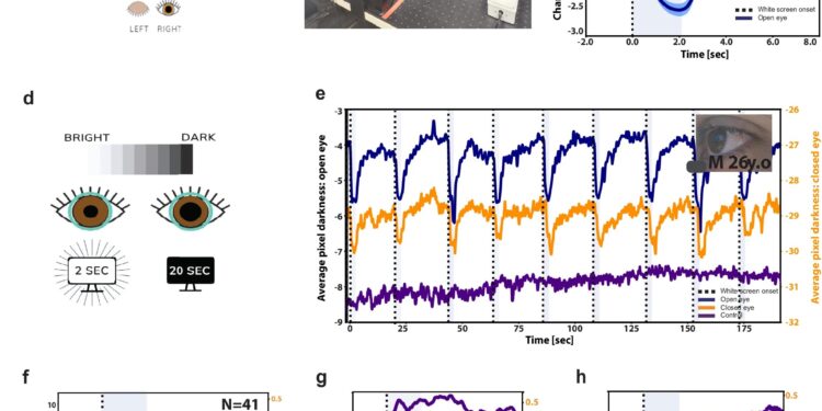 Closed-eye imaging allows monitoring of wakefulness, consciousness and pain under conditions of insensibility