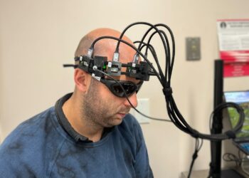 Device offers first portable and affordable method to differentiate stroke risk based on physiological conditions