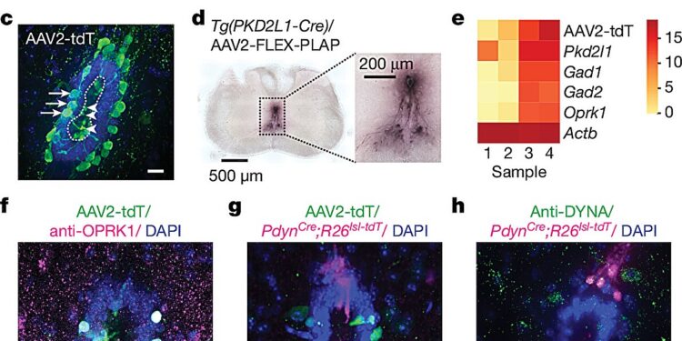 Discovery of a molecular pathway opens the way to modulation of healing of spinal cord injuries