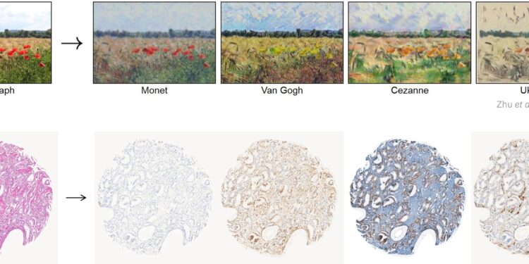 Generative AI tackles clinical predictions in cancer