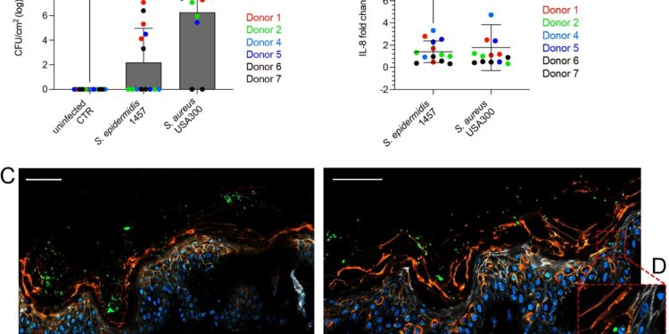 How human skin differentiates friendly bacteria from enemy bacteria