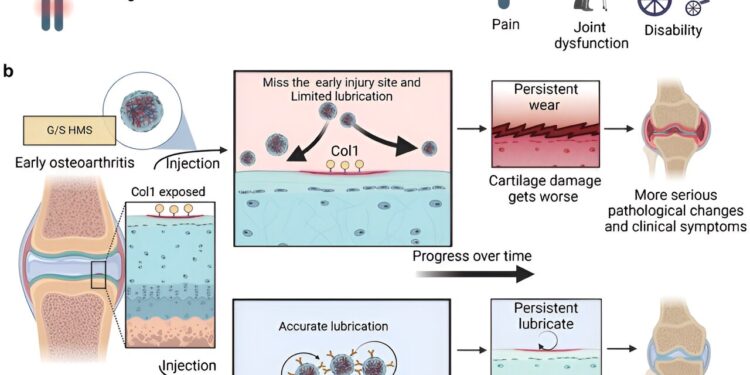 Hydrogel developed to slow or stop early stages of osteoarthritis