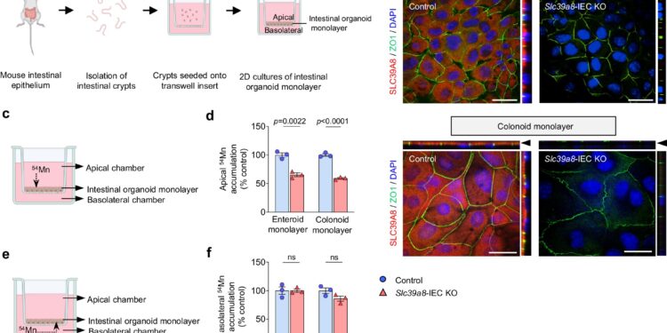 Low manganese levels may worsen inflammatory bowel disease