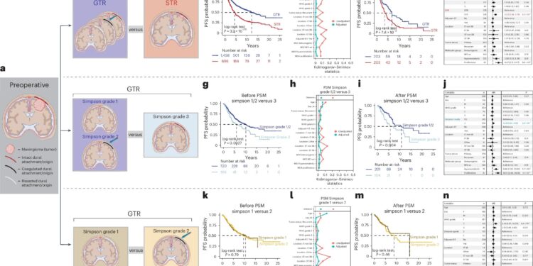 Molecular profiling may improve meningioma decision making