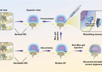 Mucin gel may help patients with herniated disc after surgery