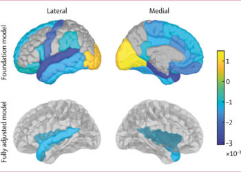 Multiple Surgeries May Contribute to Cognitive Decline in Older Adults
