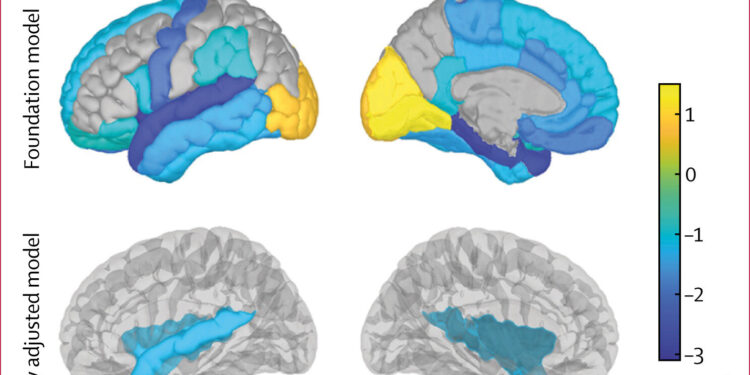 Multiple Surgeries May Contribute to Cognitive Decline in Older Adults
