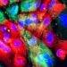 NSD2 protein may be responsible for early development of prostate cancer