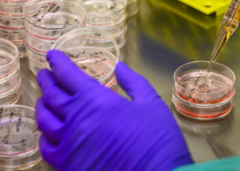 New antibodies against Klebsiella pneumoniae identified