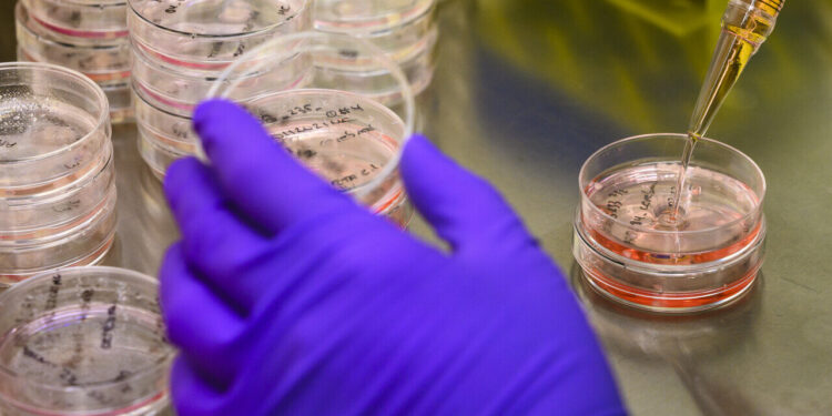 New antibodies against Klebsiella pneumoniae identified