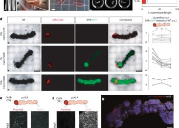 New brain organoid model replicates human cortical domains