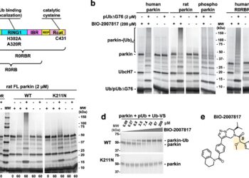 New drug molecule could help treat Parkinson’s disease in young patients