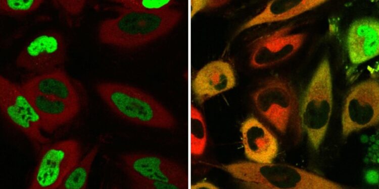 New method developed to relocate misplaced proteins in cells