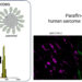 New molecular sensor enables fluorescence imaging to assess sarcoma severity