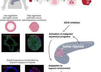 Pancreatic cancers change identity as they transform into aggressive types, organoid study reveals