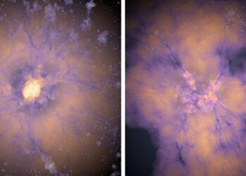 Primitive dark energy could solve cosmology’s two biggest puzzles