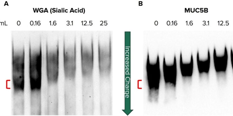Reduced sialylation of mucin impairs mucus transport in the lungs, study finds