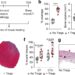 Regulatory T cells enhance tissue healing in a mouse model