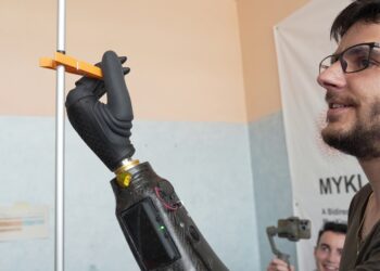 Research team develops prosthesis of the future, the first in the world with magnetic control