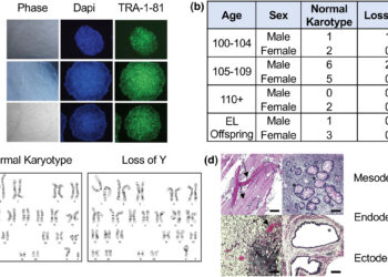 Researchers Create World’s Largest Stem Cell Bank Focused on Centenarians
