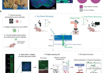 Researchers customize cutting-edge microscopy method with AI to better understand glioblastoma tumors