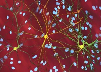 Researchers discover what hinders DNA repair in Huntington’s disease patients