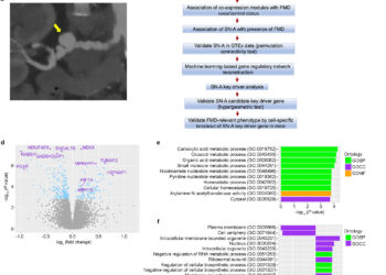 Scientists discover potential cause of enigmatic vascular disease that mainly affects women