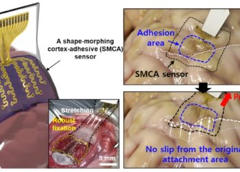 Shape-transforming brain sensor adheres to curved surfaces for ultrasound neurostimulation