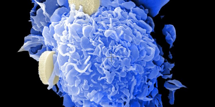 Small-molecule drug shows potential for hard-to-treat cancers